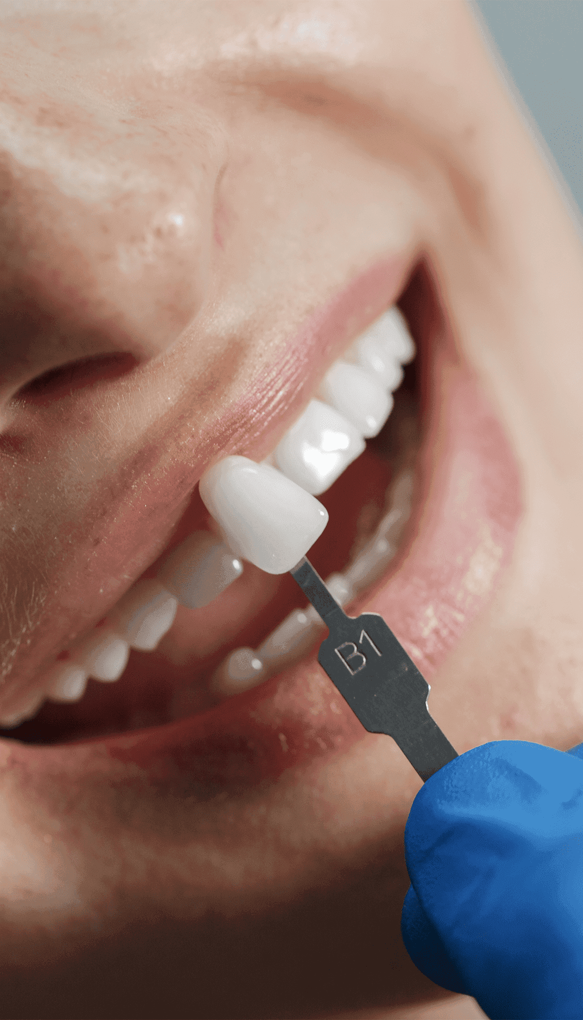 Dentística e Estética